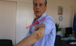 NEMEA: Δήμαρχος και αντιδήμαρχος ξυλοκοπήθηκαν από Ρομά (video)