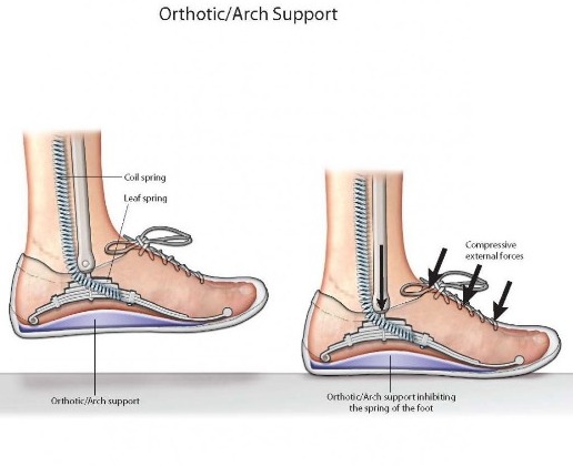 plantar 1