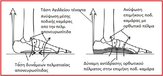 achilles 3